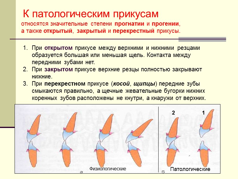 При открытом прикусе между верхними и нижними резцами образуется большая или меньшая щель. Контакта